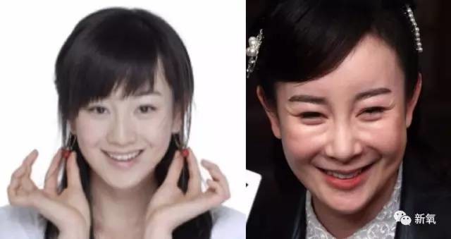张檬脸崩出新高度,她到底整错了哪里?