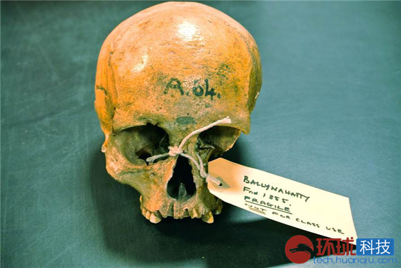 澳性工作者揭露特殊客户群 称会同等对待