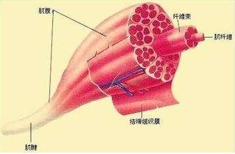 我们本文的"主人公"酱油尿则是 横纹肌溶解综合征 的表现,别